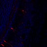 289-Fujimoto-MitralCell/Fig1O_P6_OSN-TeNT_3 thumbnail