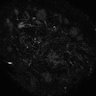 289-Fujimoto-MitralCell/Fig3D_MitTuf_cal_TTX_2 thumbnail