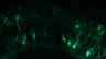 289-Fujimoto-MitralCell/Fig5G_DORA-RhoA_NMDA40uM_3 thumbnail