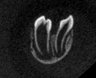 Thumbnail for dataset fig1e_splittooth