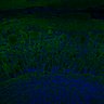 289-Fujimoto-MitralCell/FigS6A_TeNT thumbnail