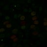 Thumbnail for dataset Fig5A_OptoDRONC
