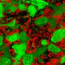 Thumbnail for dataset Fig3i_12cm_DAR_GFP