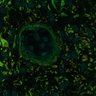 Thumbnail for dataset Fig6g_10cm_12cm_DARDAF