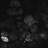 Thumbnail for Fig1D_anterior3_50_3