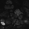 Thumbnail for dataset Fig1D_anterior3_100_3
