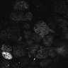 Thumbnail for Fig1D_anterior3_300_2