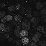 Thumbnail for Fig1D_posterior3_50_3