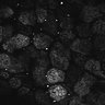 Thumbnail for Fig1D_posterior3_100_1