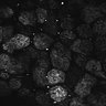 Thumbnail for Fig1D_posterior3_200_1