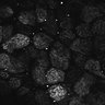 Thumbnail for dataset Fig1D_posterior3_300_2