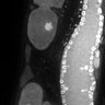 Thumbnail for dataset Fig1D_DMRE_110120-2