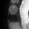 Thumbnail for dataset Fig1E_DMRE_110215-2