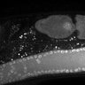Thumbnail for dataset Fig1G_DMRE_110802-5