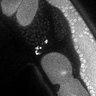 Thumbnail for dataset Fig3G_TiE_130218-3