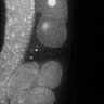 Thumbnail for Fig5E_TiE_141021-5