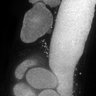 Thumbnail for dataset FigS1D_DMRE_140612-4