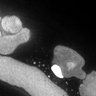 Thumbnail for FigS1D_DMRE_140707-1