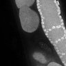 Thumbnail for dataset FigS1E_DMRE_130404-2