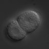 Thumbnail for dataset RNAi_C34C12.8_080325_02
