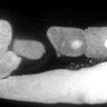 Thumbnail for dataset FigS1E_DMRE_140612-8