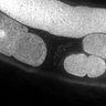 Thumbnail for dataset FigS1E_DMRE_140630-6
