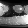 Thumbnail for FigS1G_DMRE_110210-1