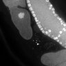 Thumbnail for dataset FigS1G_DMRE_110405-1