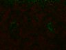Thumbnail for bnl_fig2_e_1