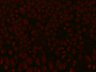 Thumbnail for dataset DEcad-GFP_figS1_2