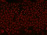 Thumbnail for dataset DEcad-GFP_video1