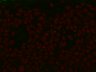 Thumbnail for dataset rho_CycA_bnl_video10