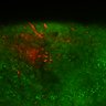 Thumbnail for dataset Fig5C_Thy1-YFP-H_injG