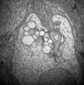 Thumbnail for dataset 20130414_1123_53_Graft4th_x12k