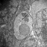 Thumbnail for dataset 20130414_1136_09_Graft4th_x6000