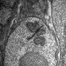 Thumbnail for 20130414_1141_25_Graft4th_x12k