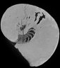 Thumbnail for dataset Metaplacenticeras_normal
