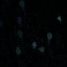 Thumbnail for dataset fig2A_p21_high