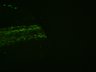 Thumbnail for dataset Fig3_amputation
