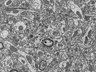 Thumbnail for dataset Fig2a_FIB-SEM_spine_synapse