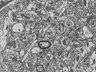 Thumbnail for dataset Fig2b_FIB-SEM_spine_synapse