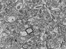 Thumbnail for Fig2e_FIB-SEM_shaft_synapse