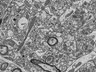 Thumbnail for dataset Fig2f_FIB-SEM_shaft_synapse