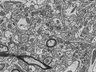 Thumbnail for dataset Fig3a_FIB-SEM_synapse