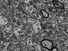 Thumbnail for dataset Fig3c_FIB-SEM_synapse