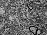 Thumbnail for dataset Fig3d_FIB-SEM_synapse