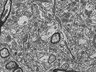 Thumbnail for dataset Fig3j_FIB-SEM_synapse