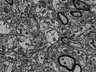 Thumbnail for dataset Fig3k_FIB-SEM_synapse