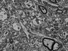 Thumbnail for Fig3l_FIB-SEM_synapse