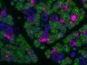 Thumbnail for dataset SuppFigure1c_6W_AQP5_Sox9